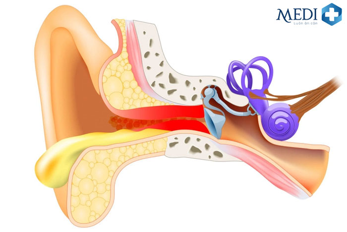 Viêm tai giữa có thể gây ra nhiều biến chứng nguy hiểm.