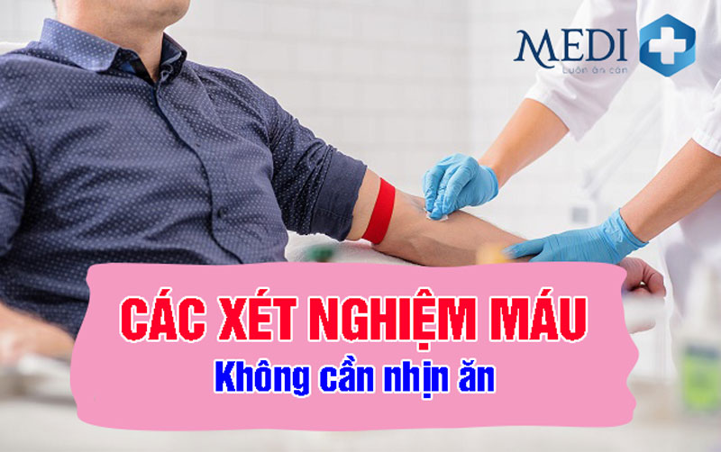 Xét nghiệm máu nào không cần nhịn ăn?