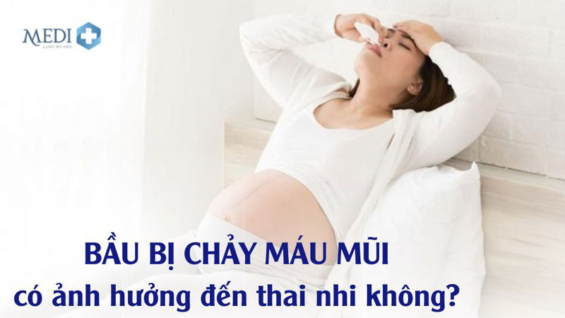 Bầu bị chảy máu mũi có sao không có ảnh hưởng đến thai nhi?