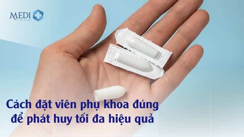 Cách đặt viên phụ khoa tại nhà đúng cách an toàn hiệu quả