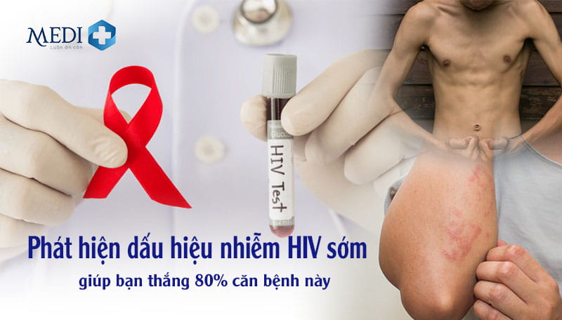 Dấu hiệu nhiễm HIV sớm ở cả nam và nữ từng giai đoạn