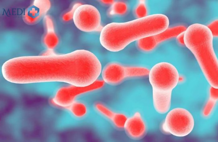 Trực khuẩn Clostridium là nguyên nhân chính gây bệnh uốn ván