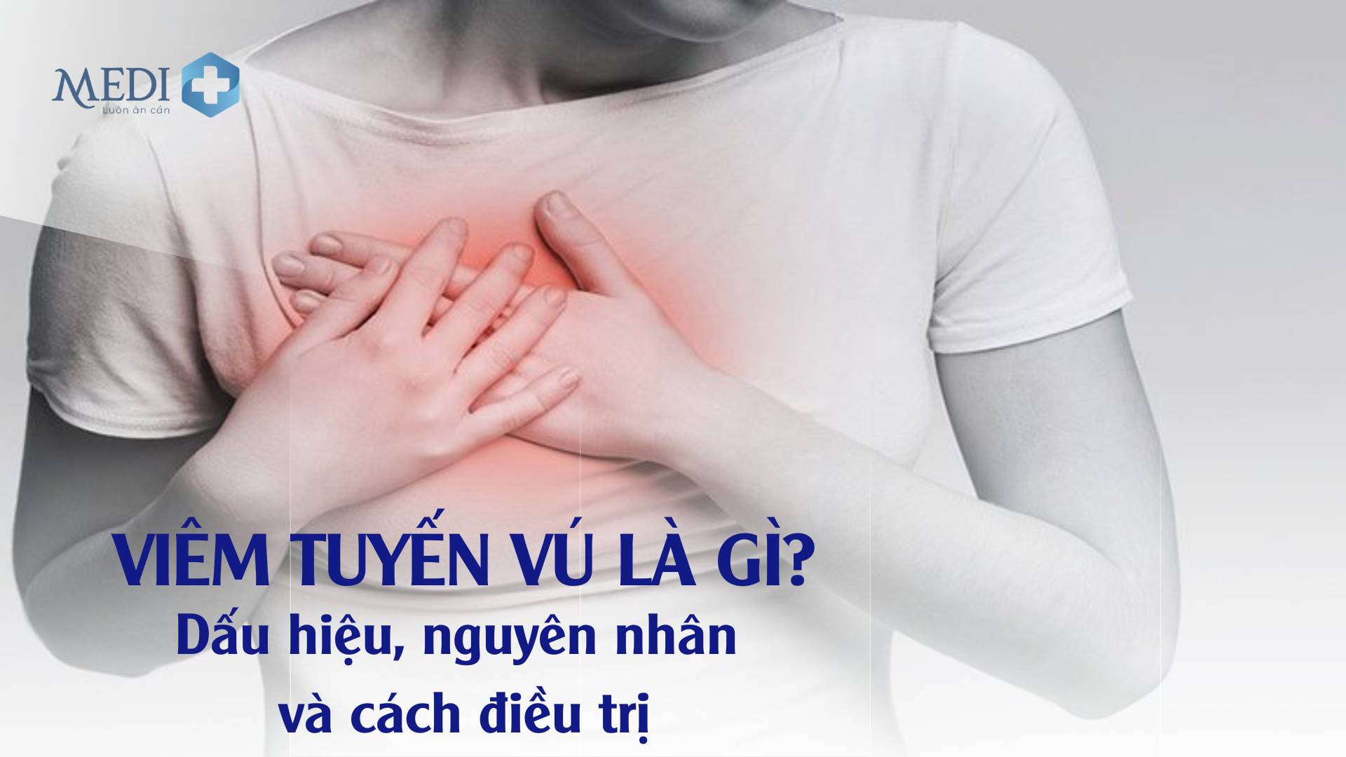 Viêm tuyến vú là gì? Nguyên nhân và dấu hiệu nhận biết