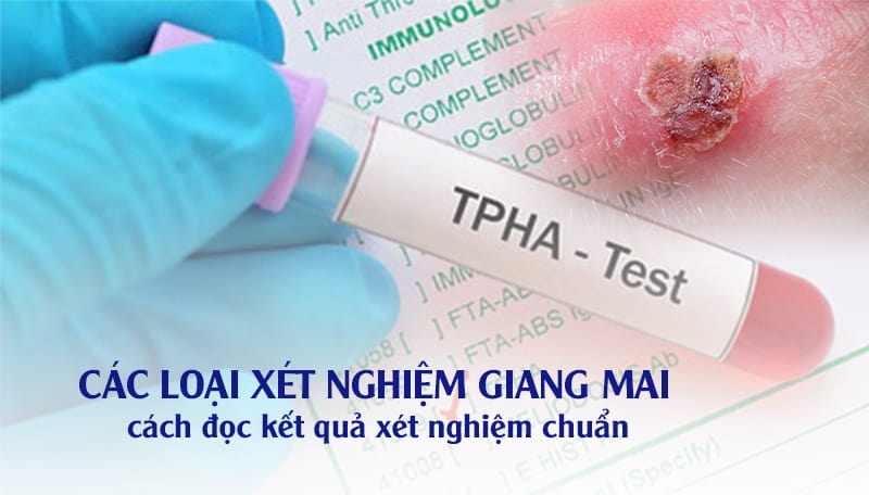 Các loại xét nghiệm giang mai và cách đọc kết quả đúng chuẩn