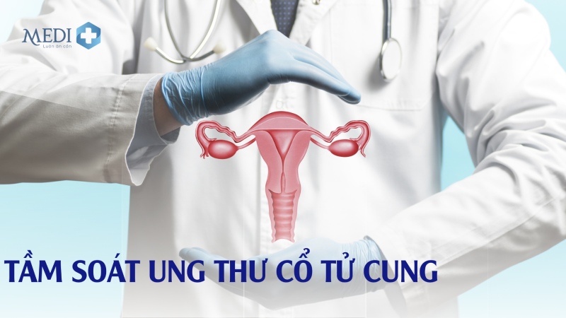 Tầm soát ung thư cổ tử cung: Quy trình, phương pháp, chi phí