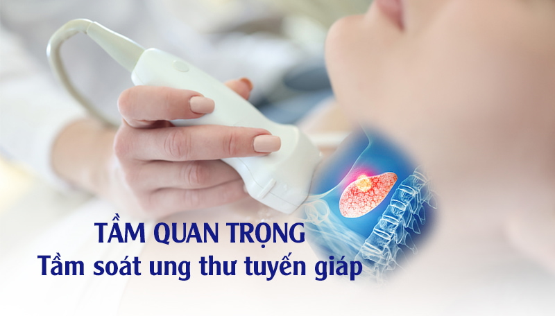 Tầm soát ung thư tuyến giáp phát hiện sớm điều trị hiệu quả