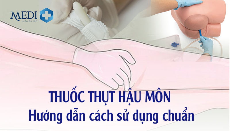 Thuốc thụt hậu môn là gì? Lưu ý sử dụng để tránh tác dụng phụ