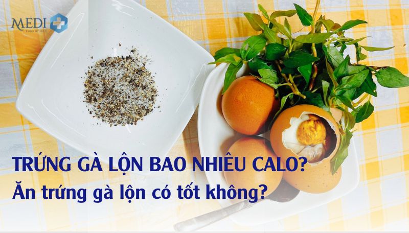 Trứng gà lộn bao nhiêu calo? Lưu ý khi ăn trứng gà lộn