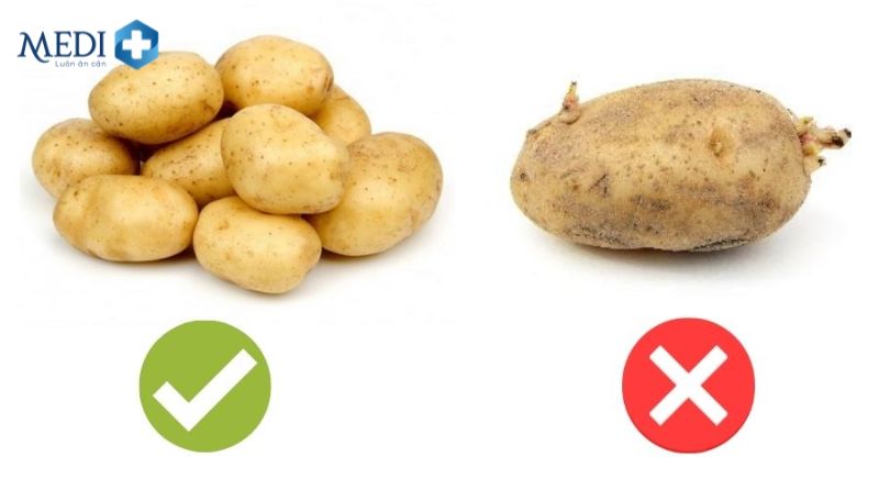 Cách chọn khoai tây