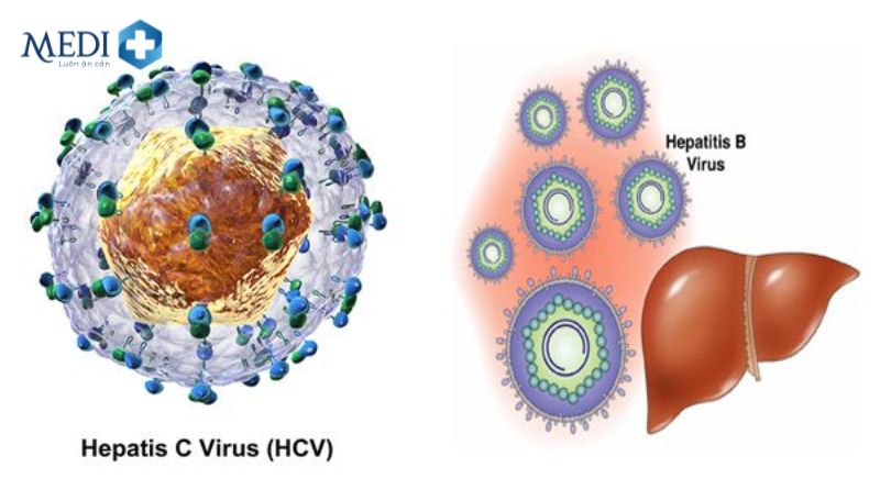 Cây cơm nguội chữa viêm gan do virus