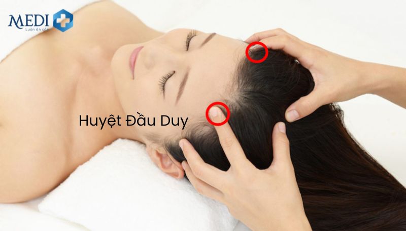 Huyệt Đầu Duy thường được ứng dụng trong điều trị chứng đau đầu