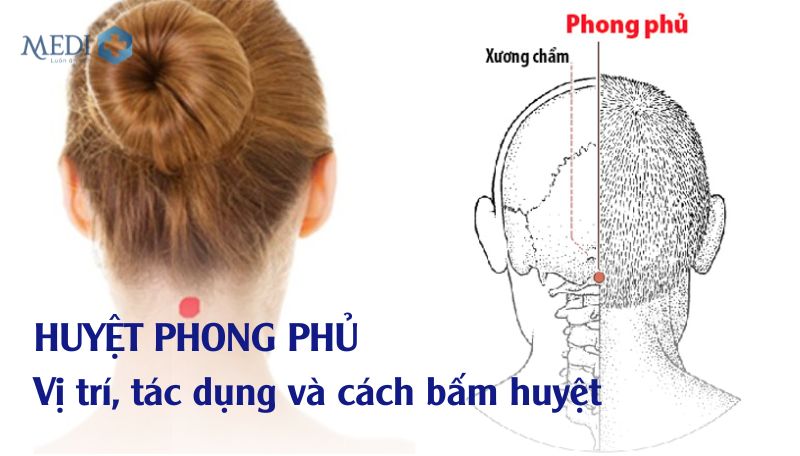 Huyệt Phong Phủ