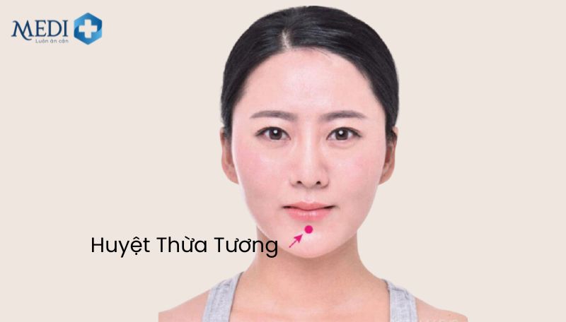 Công dụng của huyệt thừa tương là điều trị chứng cứng cổ