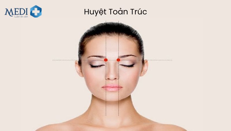 Huyệt Toản Trúc nằm ở phần lõm của đầu lông mày