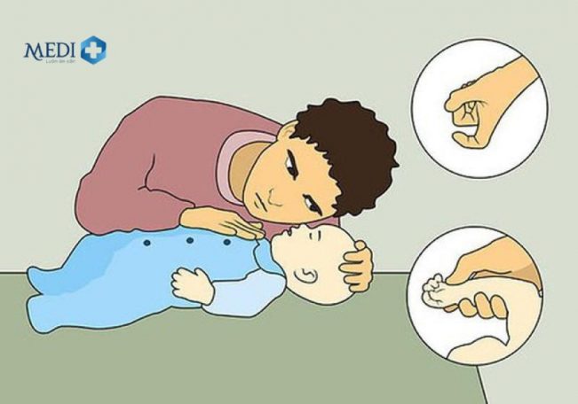 Hướng dẫn cách hồi sinh tim phổi (CPR) an toàn kịp thời