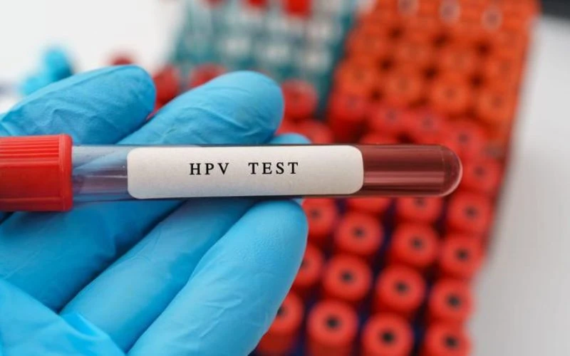 Xét nghiệm HPV cũng thường được thực hiện cùng xét nghiệm Pap