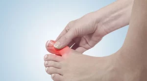 Ngón chân cái bị đau buốt là bệnh gì?