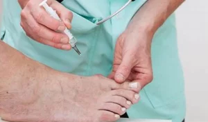 Điều trị ngón chân cái bị đau buốt hiệu quả 