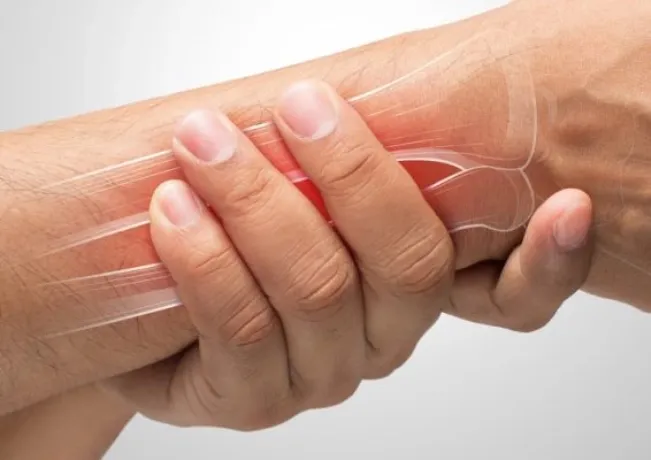Các phương pháp chẩn đoán bệnh đau cổ tay nhưng không sưng?