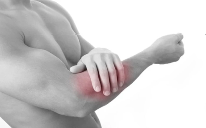 Đau cánh tay phải và tay trái: Nguyên nhân và phương pháp điều trị.