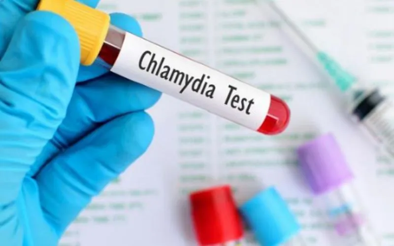 Bệnh Chlamydia lây qua đường quan hệ tình dục bằng miệng