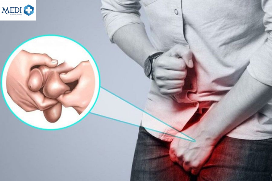 Đau tinh hoàn bên trái có gây nguy hiểm không?