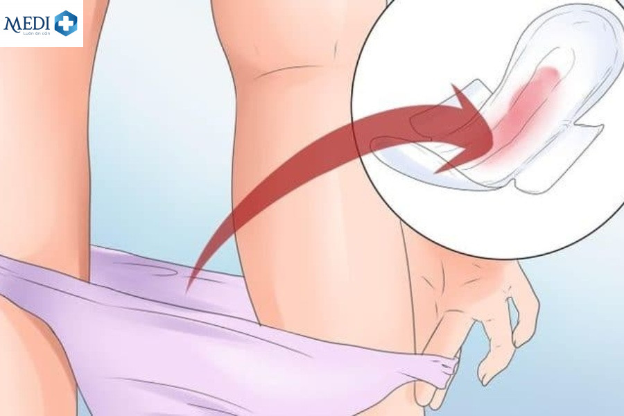  Nguyên nhân vừa hết kinh quan hệ ra máu nhưng không phải mang thai