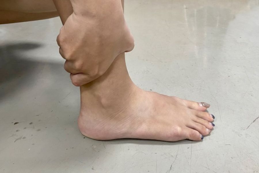 Có nhiều nguyên nhân gây ra bệnh gout