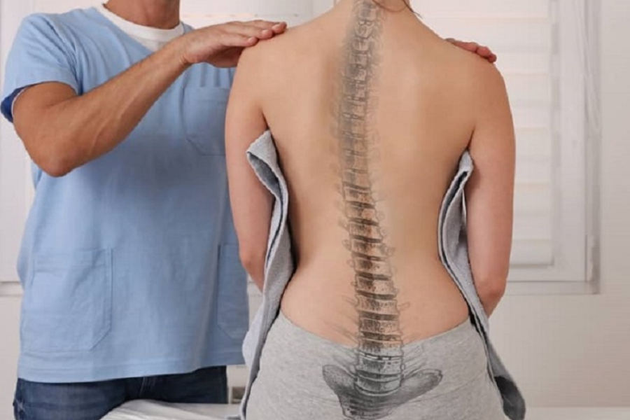 Chẩn đoán cong vẹo cột sống bằng cách nào?