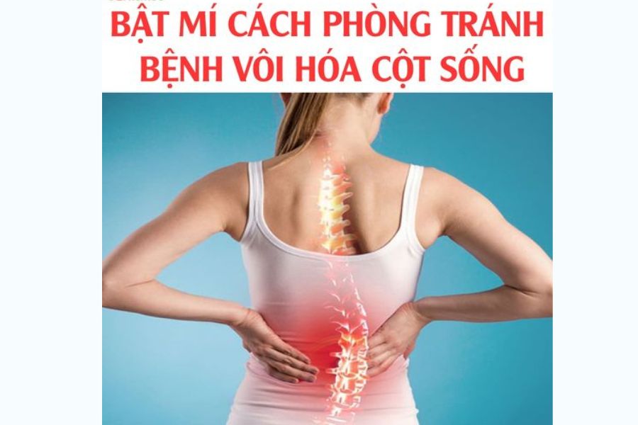 Có những cách phòng chống bệnh vôi hoá nào?