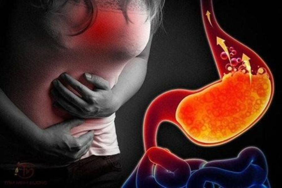 Người bệnh trào ngược dạ dày có chữa khỏi được không? 
