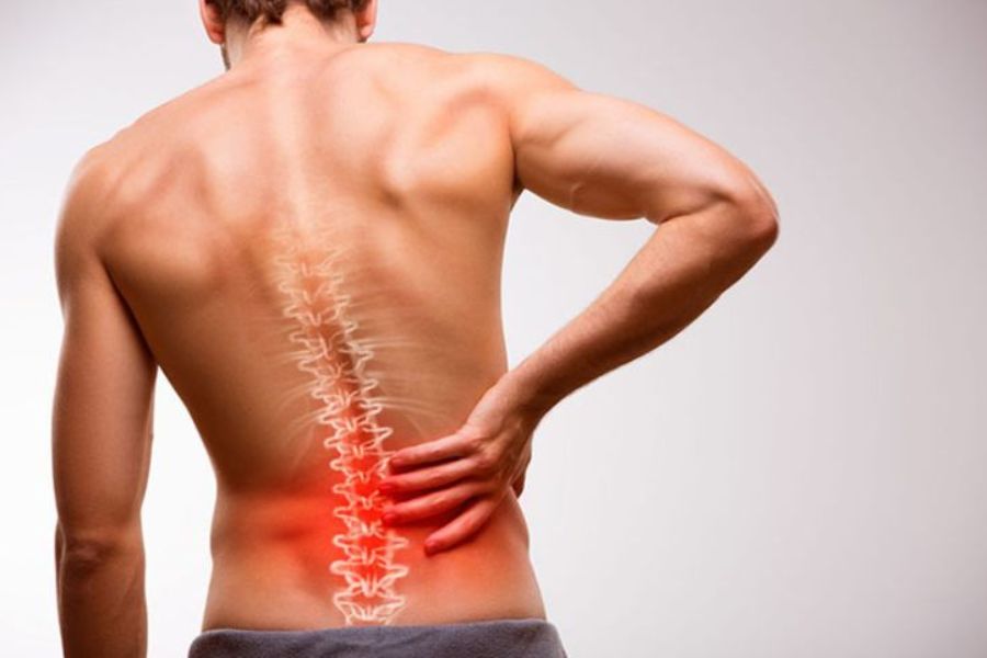 Sau phẫu thuật vẹo cột sống bệnh có thể tái phát, các cơn đau kéo dài