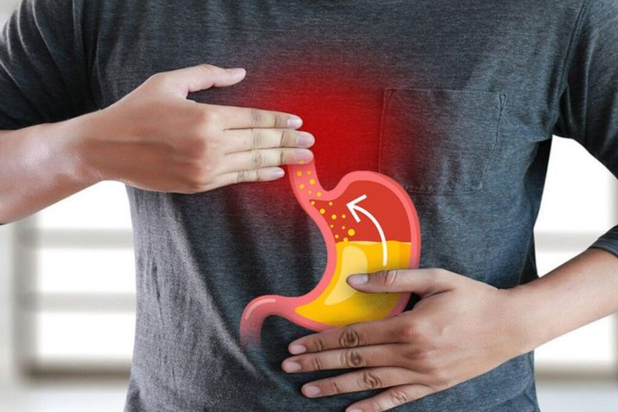 Trào ngược dạ dày có tự khỏi không? 5 Lưu ý khi chữa bệnh 