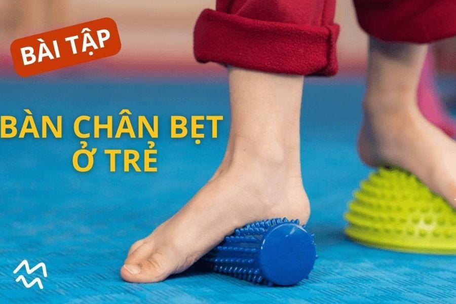 Tập vật lý trị liệu để điều trị bàn chân bẹt