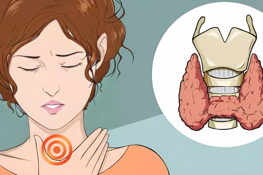 Kiêng nói sau mổ tuyến giáp bao lâu? 4 Lưu ý