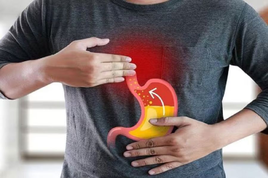 Lời khuyên phòng ngừa bệnh trào ngược dạ dày thực quản