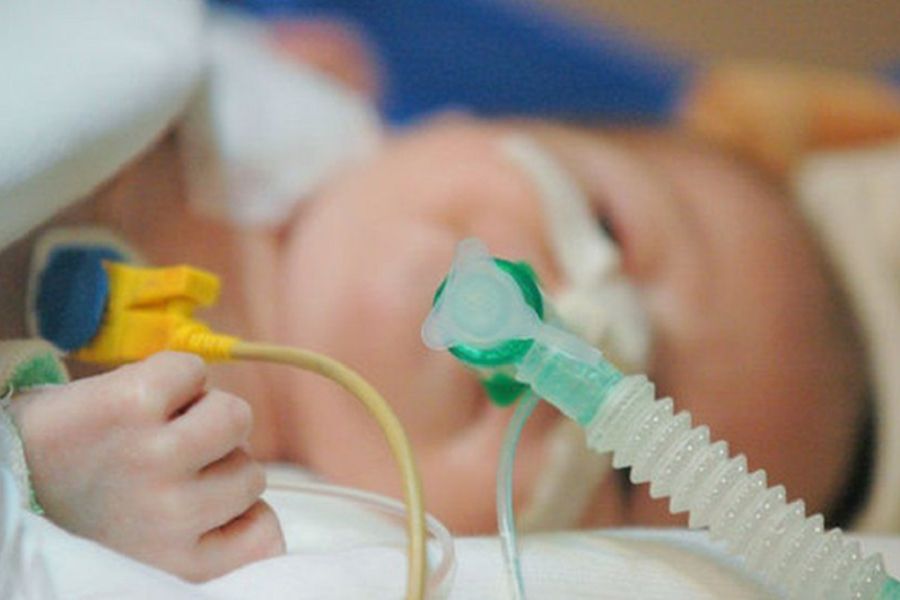 Sau phẫu thuật bé cần được theo dõi kỹ để tránh các biến chứng