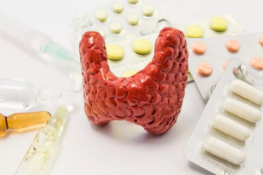 U tuyến giáp uống thuốc gì? Gợi ý 3 loại