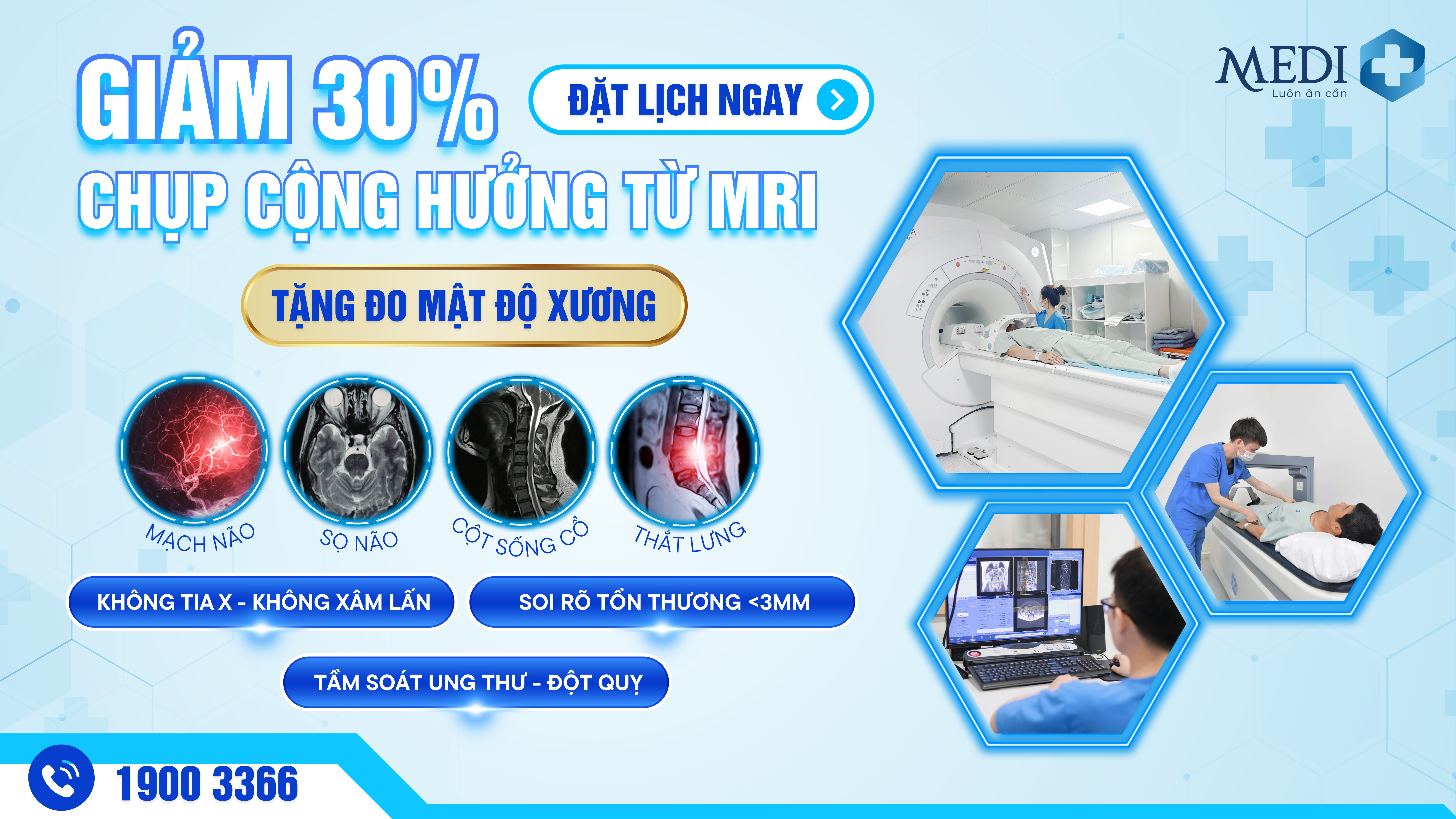 Giảm 30% chụp cộng hưởng từ MRI – Tặng đo mật độ xương