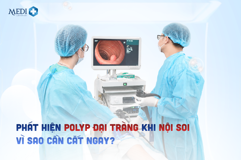 Phát hiện polyp đại tràng khi nội soi: Vì sao cần cắt ngay?