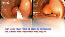[NAM ĐỊNH] Phát hiện 8 polyp đại tràng từ triệu chứng hay đi ngoài phân lỏng sau khi uống rượu bia